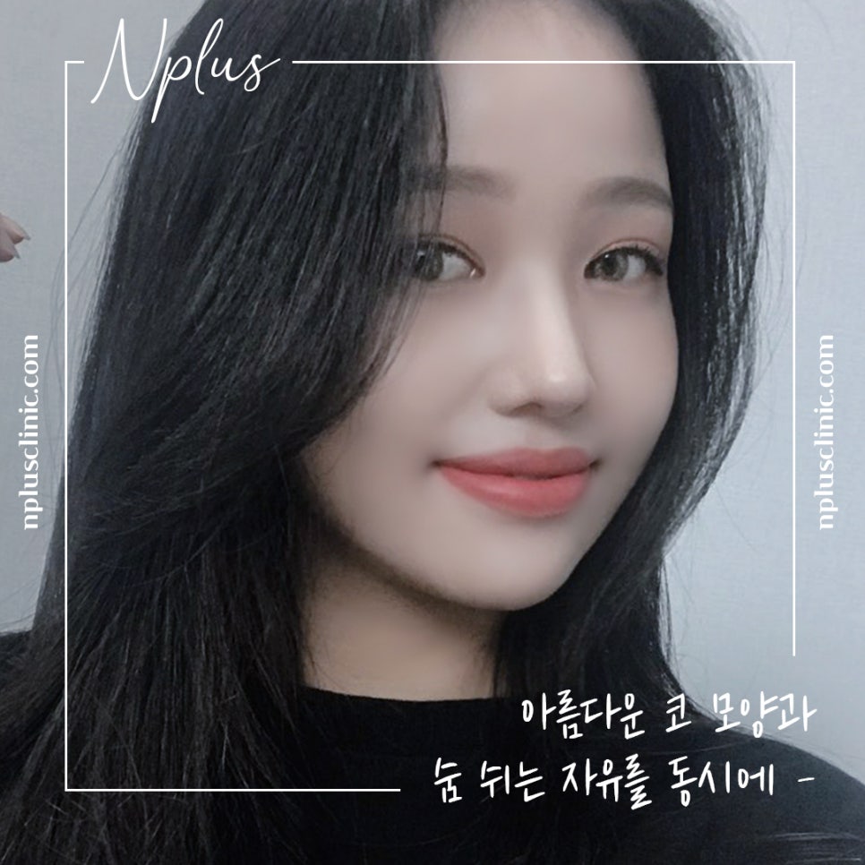 자가늑연골코성형으로 세련된 이미지로 변신 관련 이미지 15