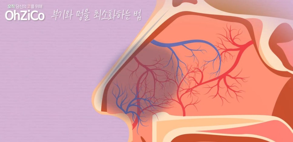 How to Reduce Swelling Quickly After Nose Surgery! image 13