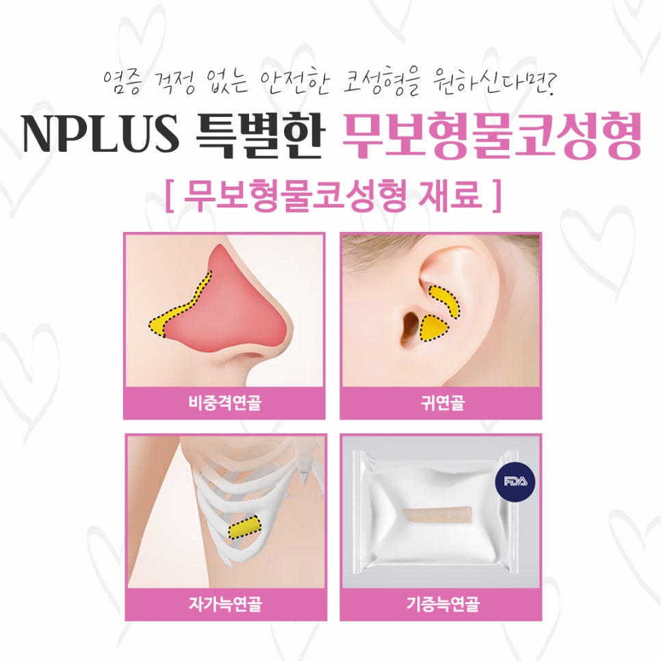 Checking Whether Non-Implant Nose Surgery Is Possible image 4