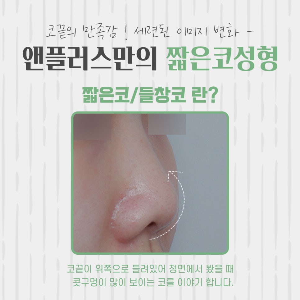 Learn About Short Nose Surgery Properly image 3