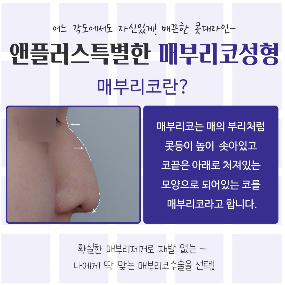An Image Changed by Hump Nose Surgery Reviews image 3