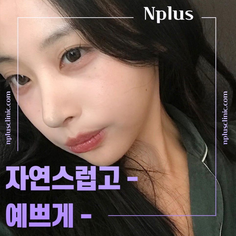 기능코성형후기에 대한 체크리스트 관련 이미지 8