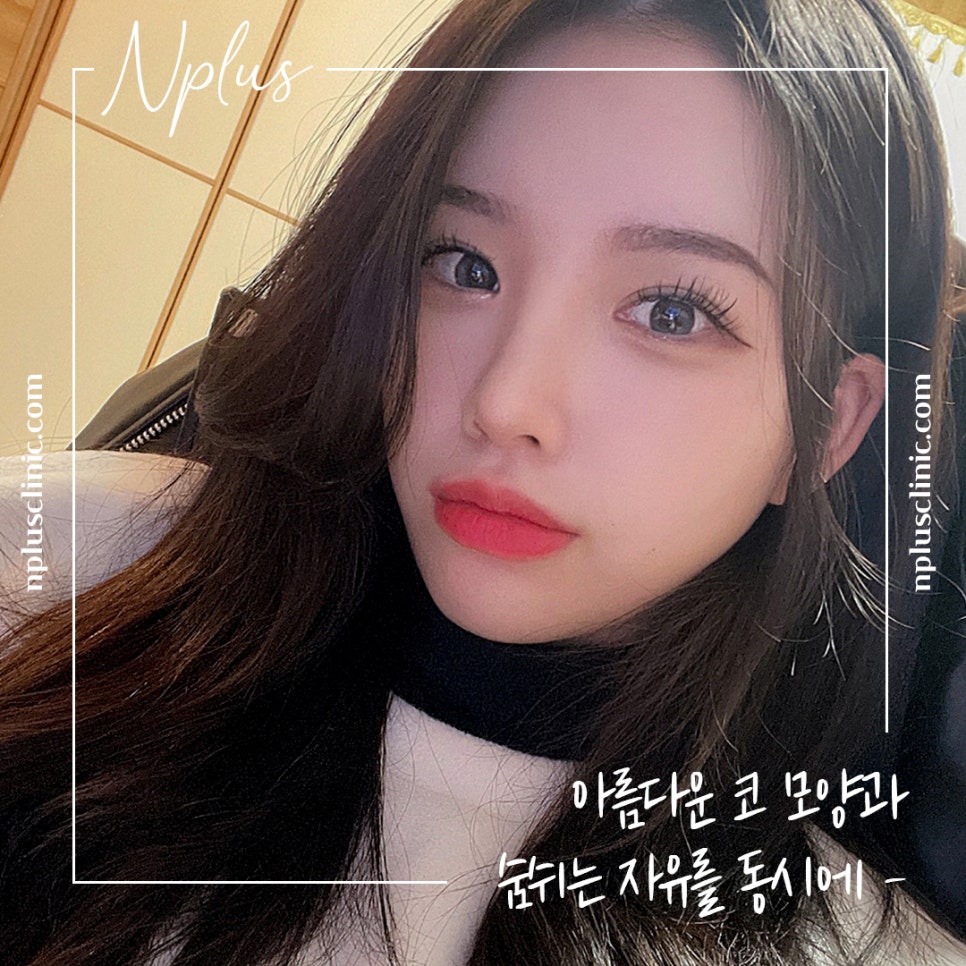 콧볼축소후기 섬세하게 알아보고 관련 이미지 1