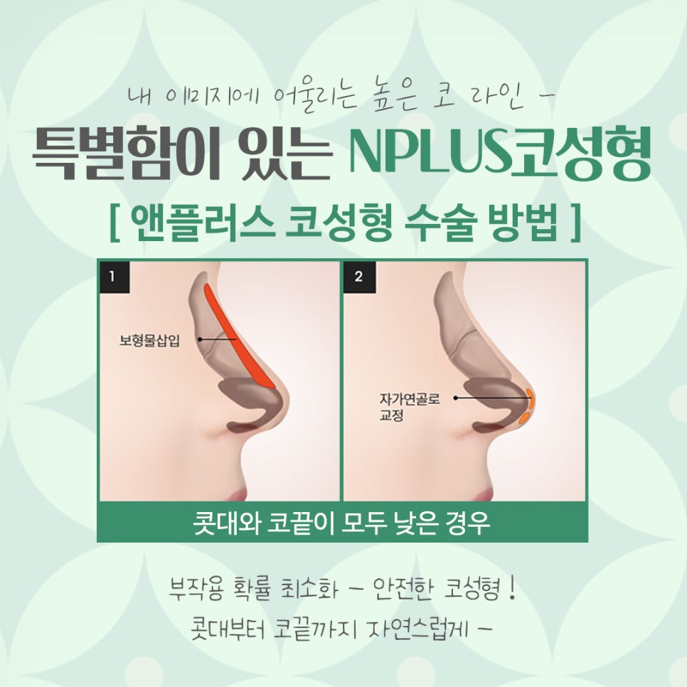 Looking into a Nose Surgery Clinic in Detail image 7