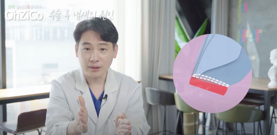 코수술 후 코냄새 원인과 해결 방법! 관련 이미지 11