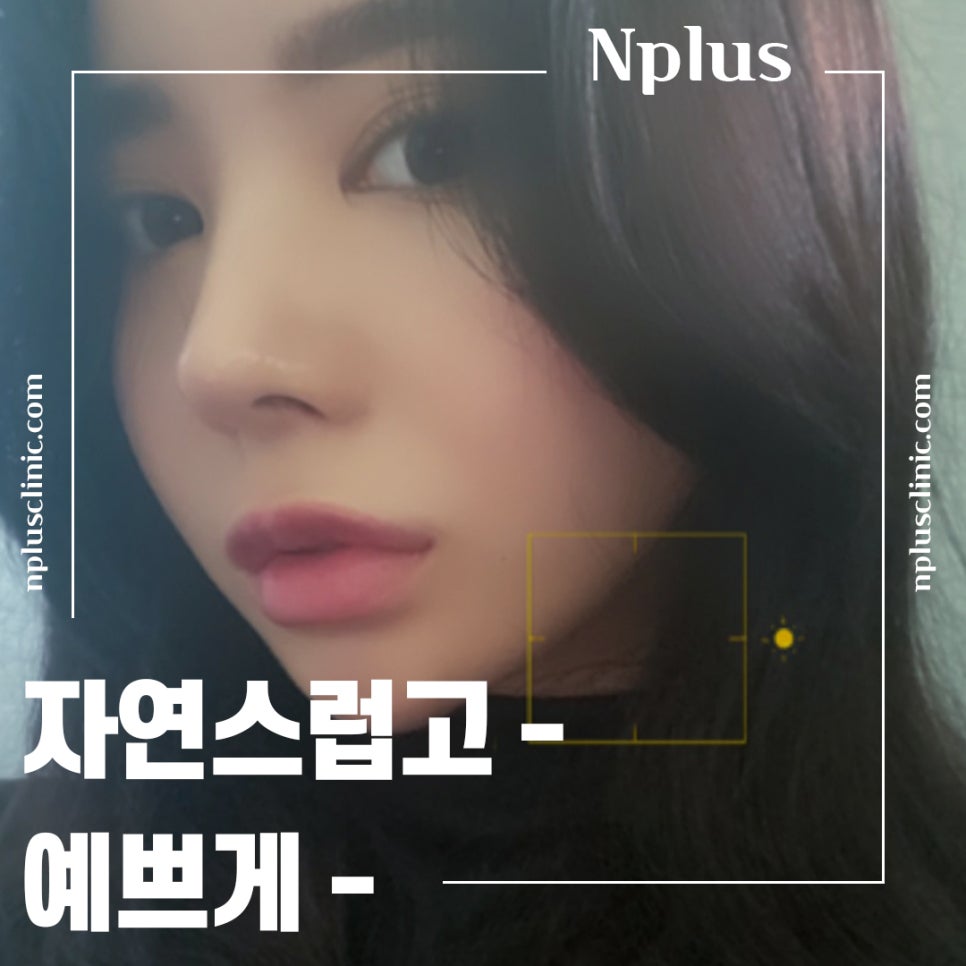짧은코성형후기 자연스럽고 예쁘게 관련 이미지 2
