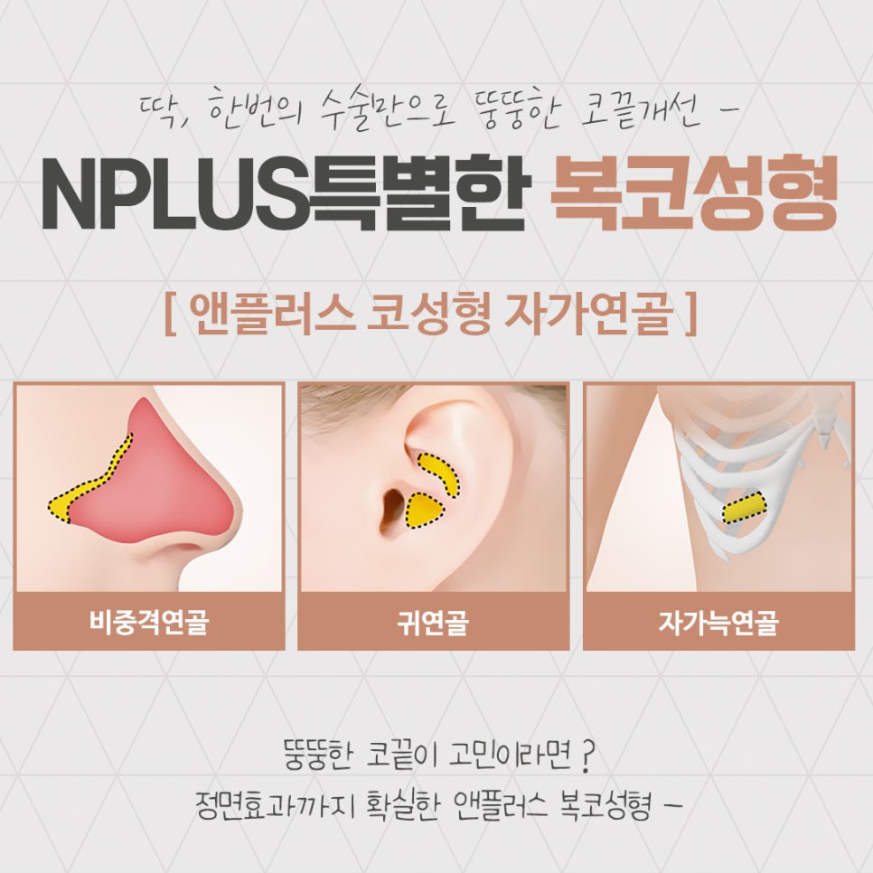 복코성형후기를 다양하게 찾아보고 관련 이미지 12