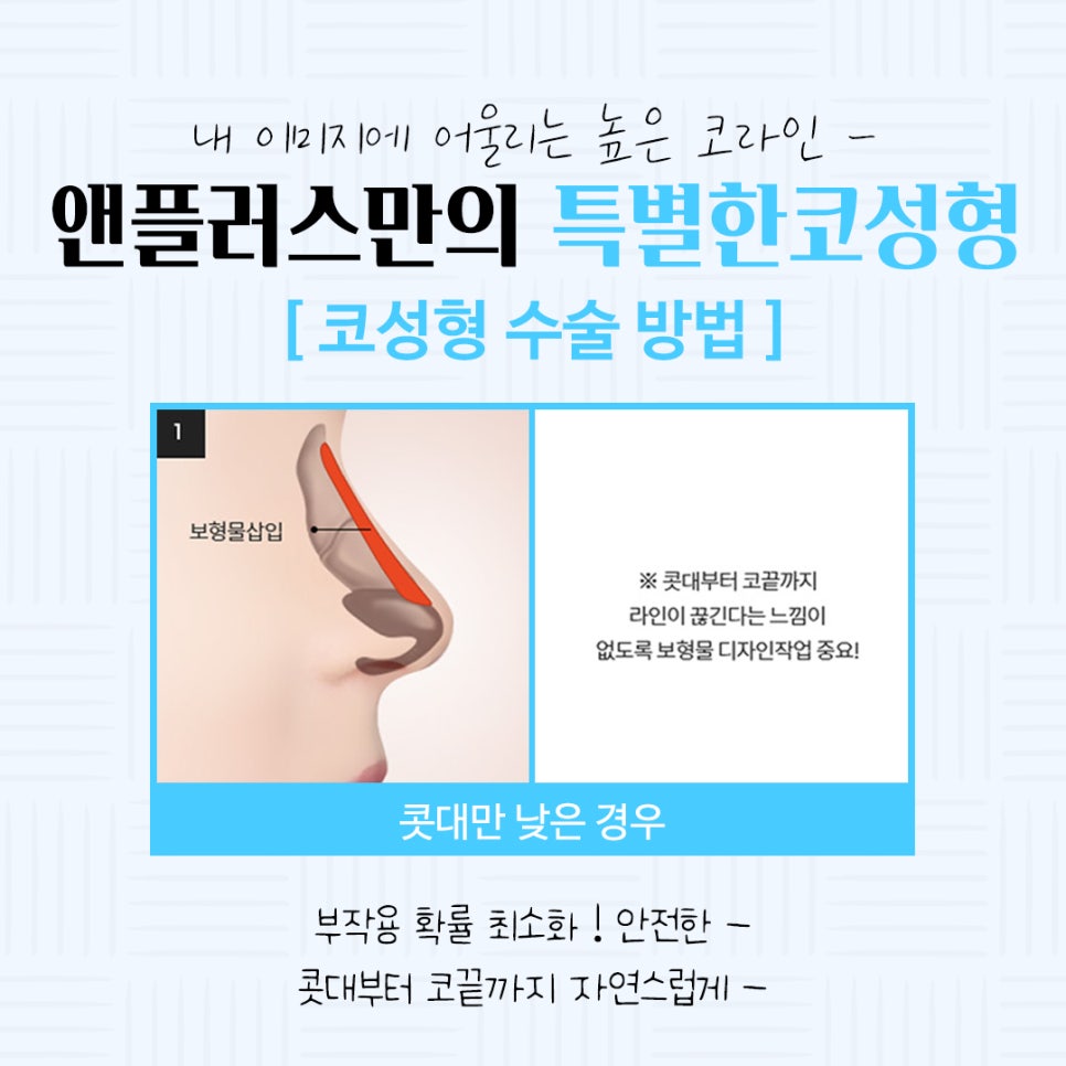 Learn About Autologous Cartilage Rhinoplasty image 9