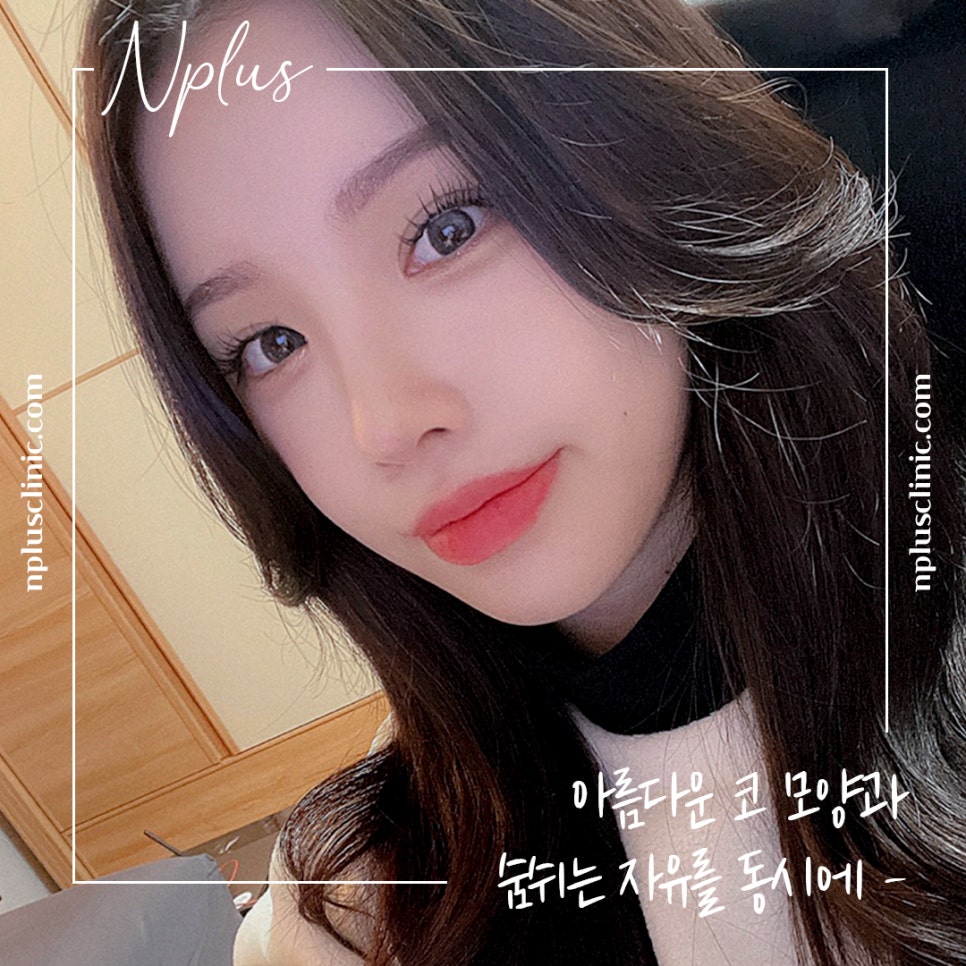 콧볼축소후기 섬세하게 알아보고 관련 이미지 12