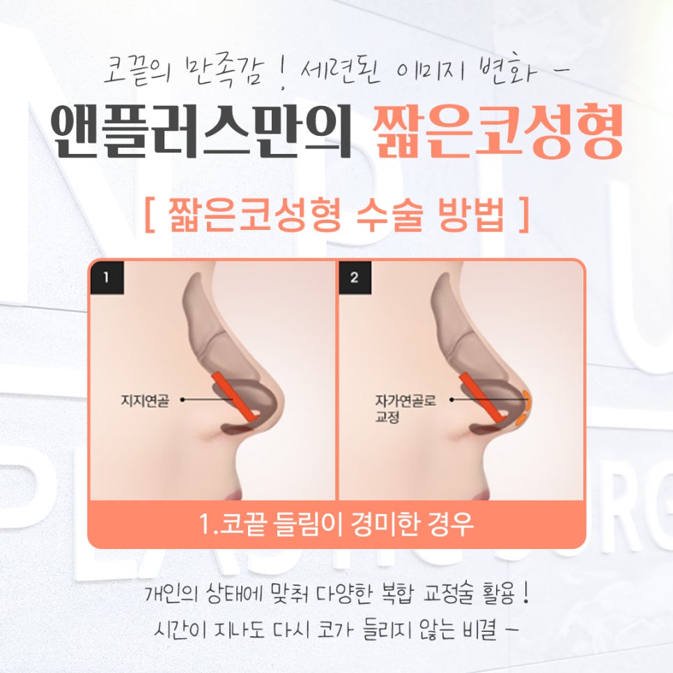 짧은코성형에 대한 차이를 알아보고 관련 이미지 9