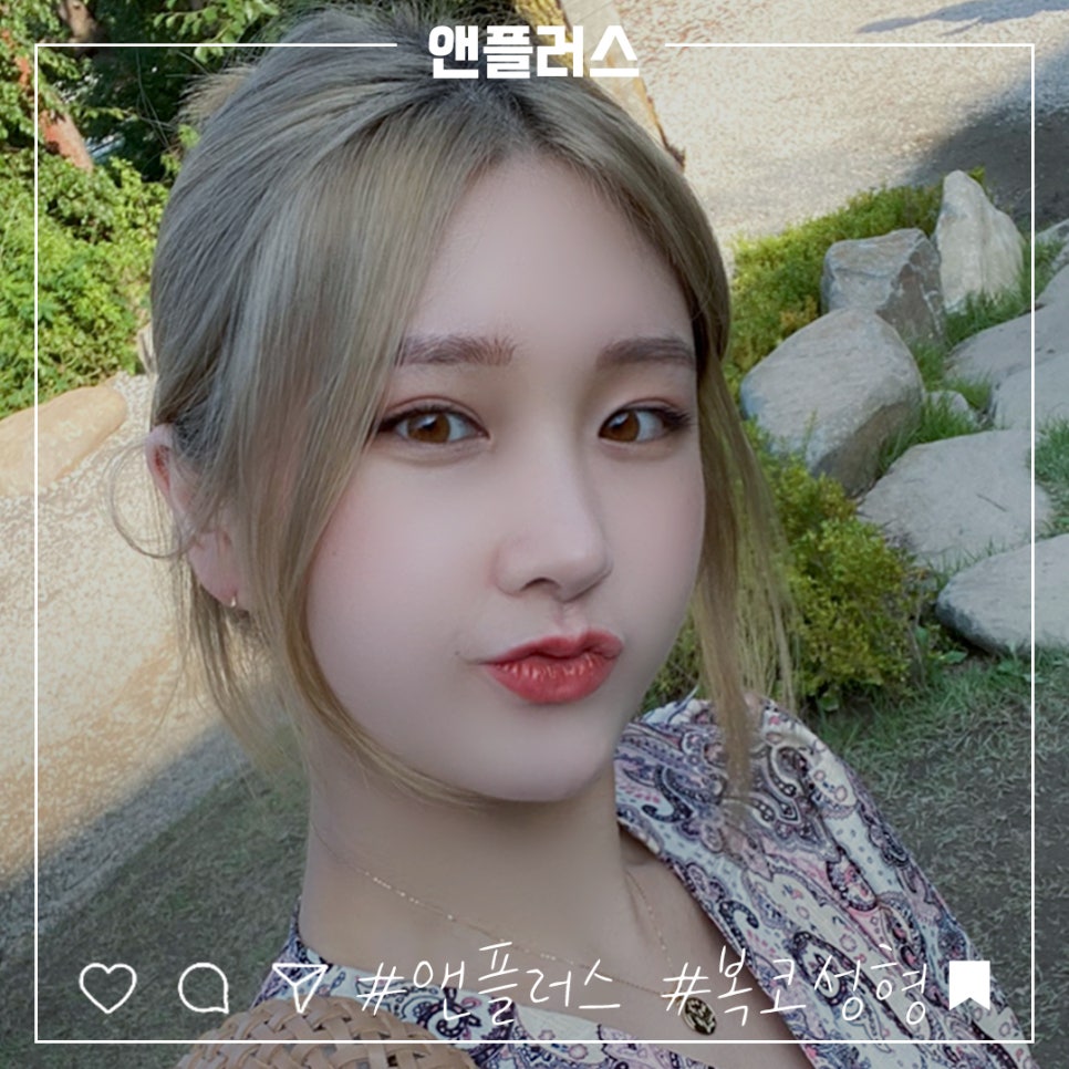 복코수술후기 세련된 인상으로 관련 이미지 1