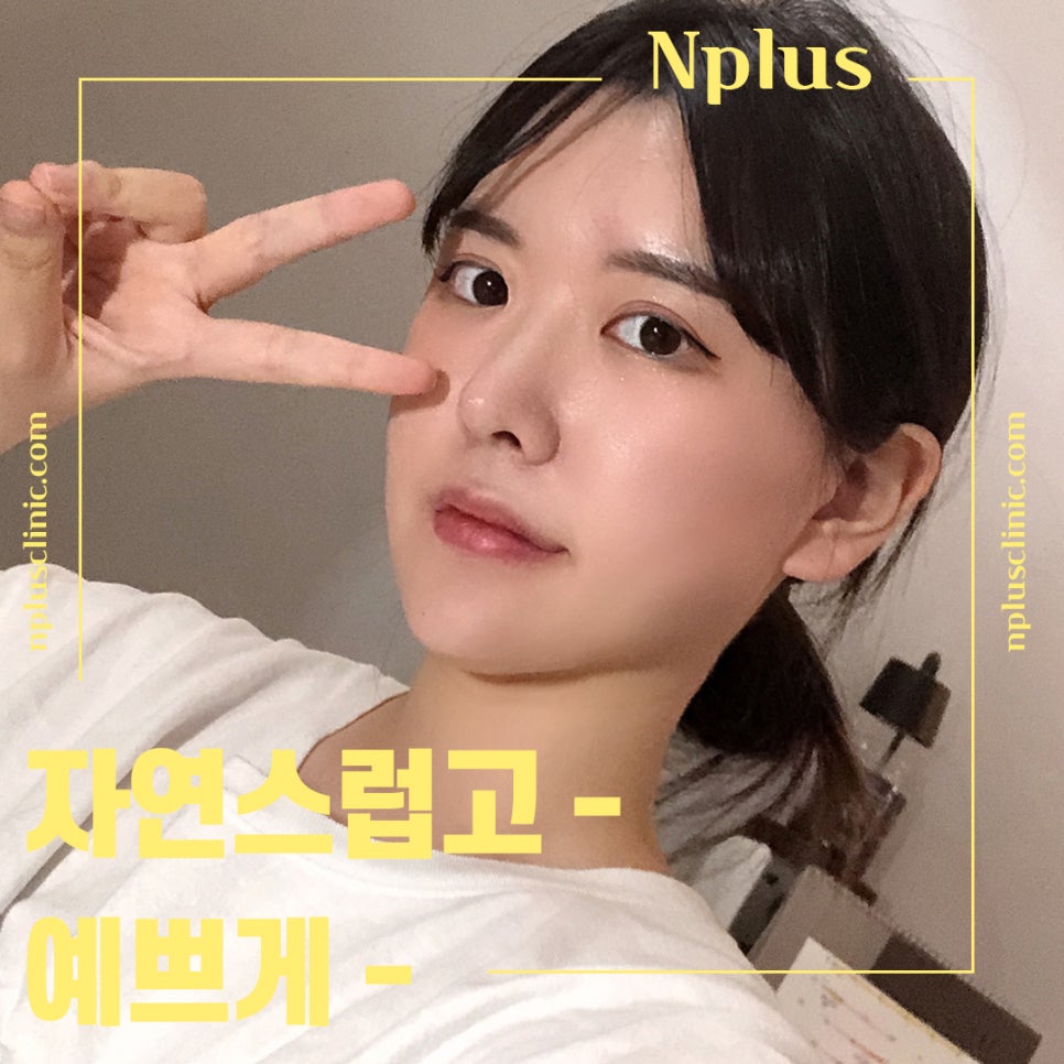 화살코성형 후기까지 확실하게 관련 이미지 14