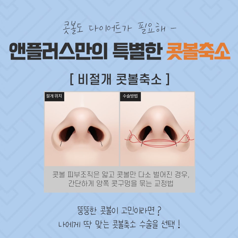 콧볼축소후기 섬세하게 알아보고 관련 이미지 9