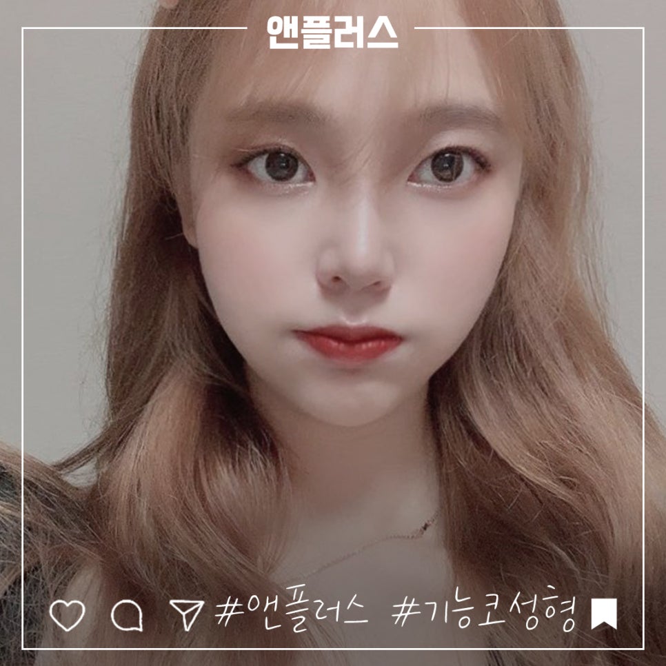 Female Rhinoplasty Review: A Line That Suits You image 4