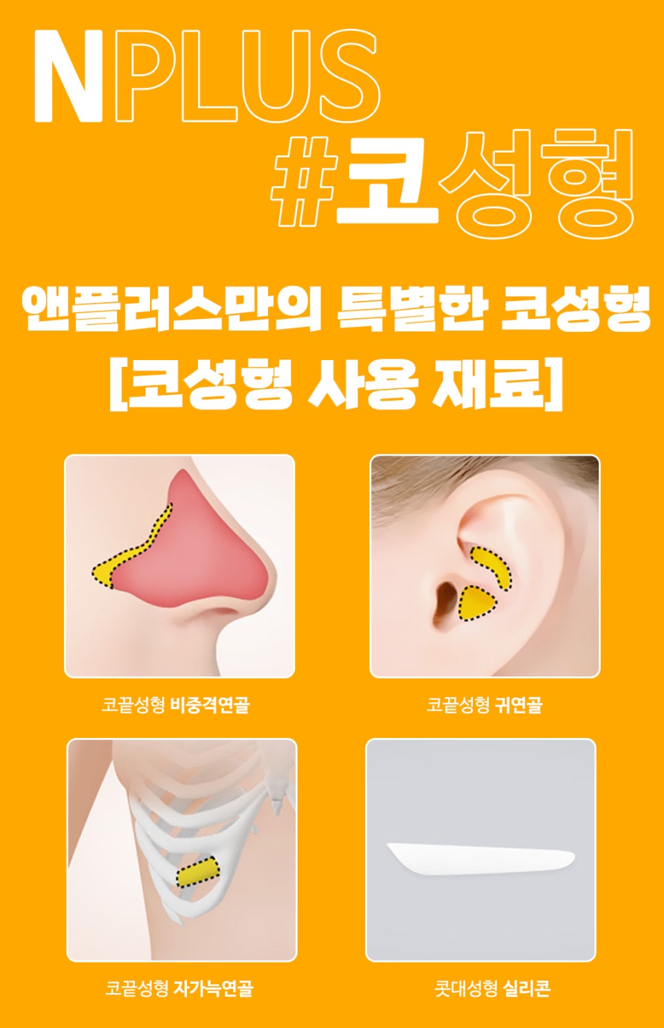 콧대수술_비염기능까지 고려해서 관련 이미지 5