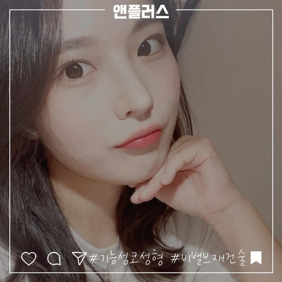 비밸브재건술을 통한 숨 쉬는 자유 관련 이미지 13