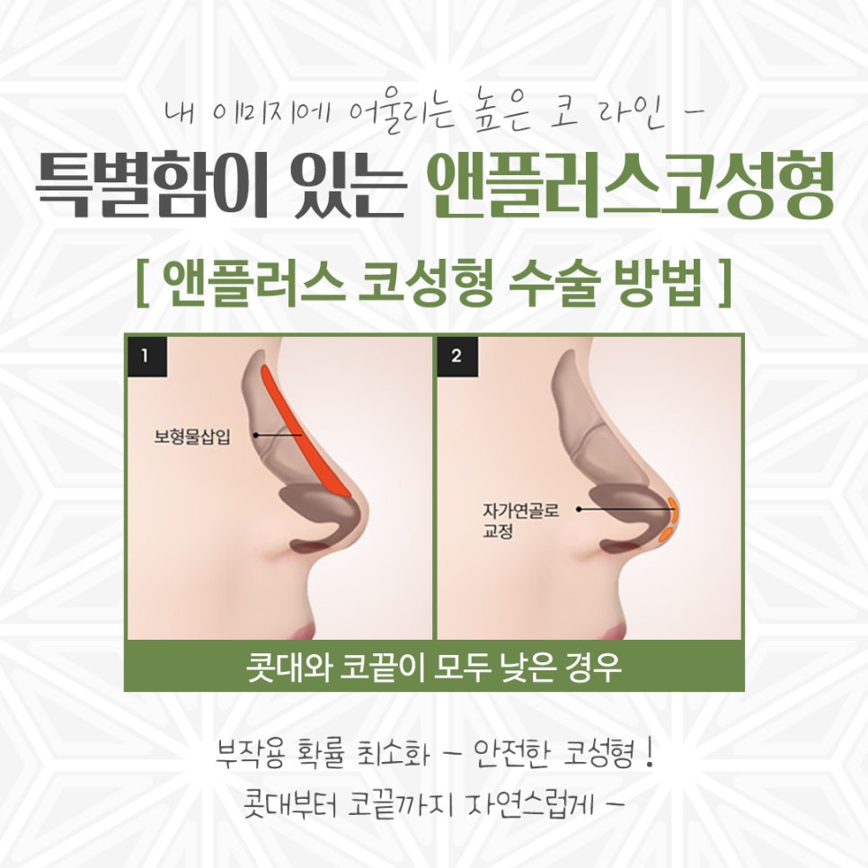 Make Sure to Review Rhinoplasty Costs Carefully Before Deciding image 7