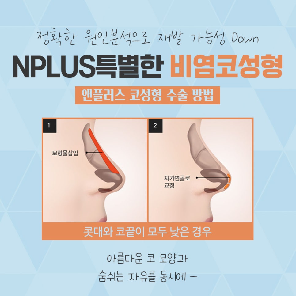 비염수술코성형 한 번의 선택으로 관련 이미지 2