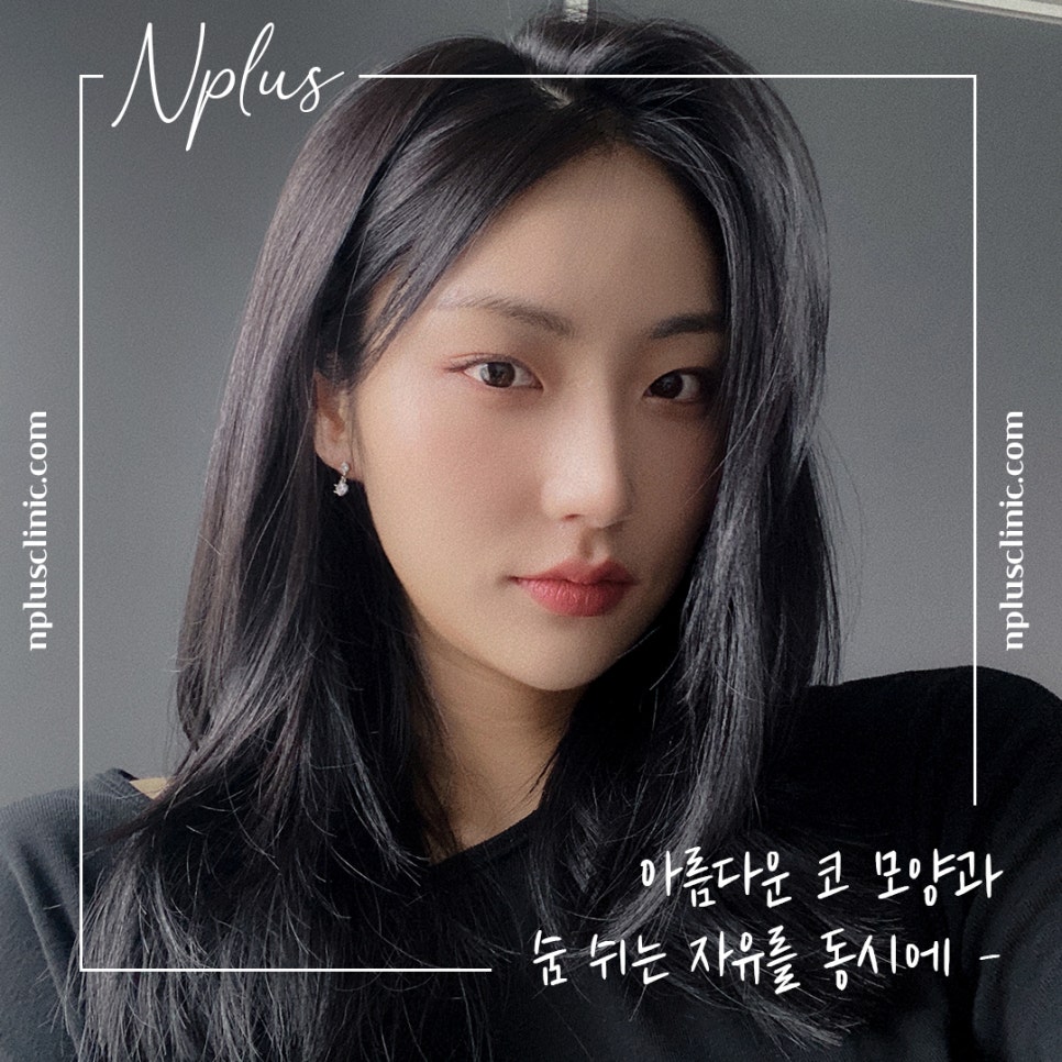 자가늑연골코수술 세련된 이미지로 관련 이미지 2