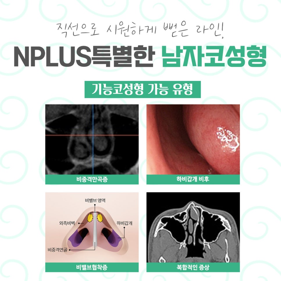 남자코성형 전체적인 라인을 고려하여 관련 이미지 5
