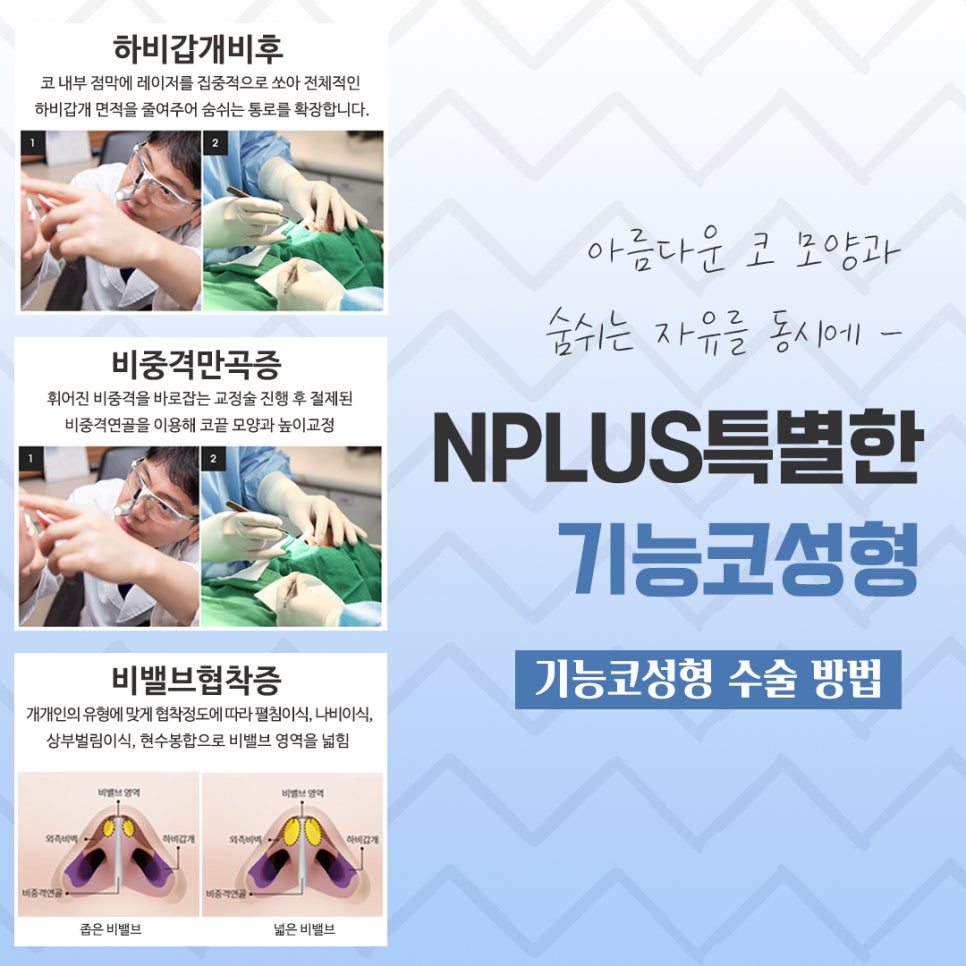 비염수술전후 확실한 차이를 알아보고 관련 이미지 8