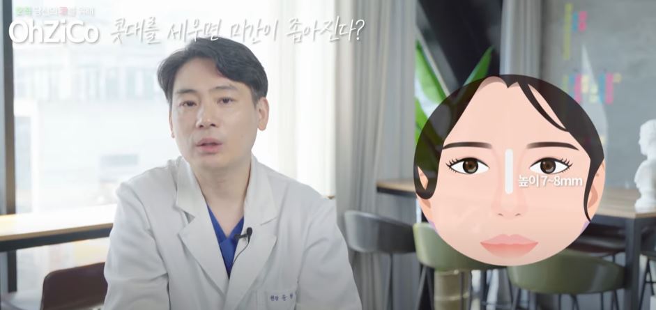 코성형 후 눈몰림 걱정된다면? 관련 이미지 13