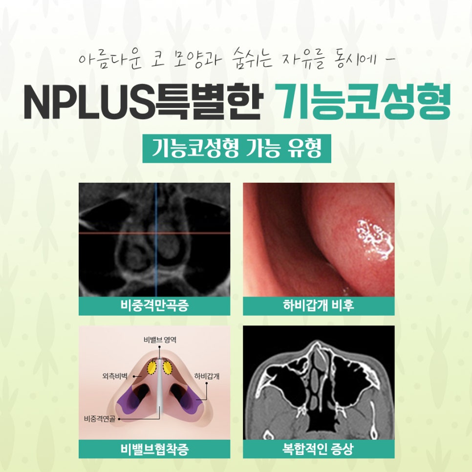 기능코수술후기에 대한 내용을 비교하여 관련 이미지 5