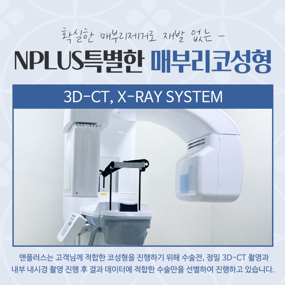 Hump Nose Surgery Review with an Accurate Diagnosis image 7