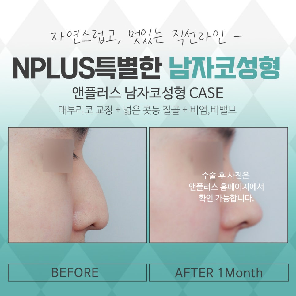 남자코성형후기 기능에 대해 알아보고 관련 이미지 15