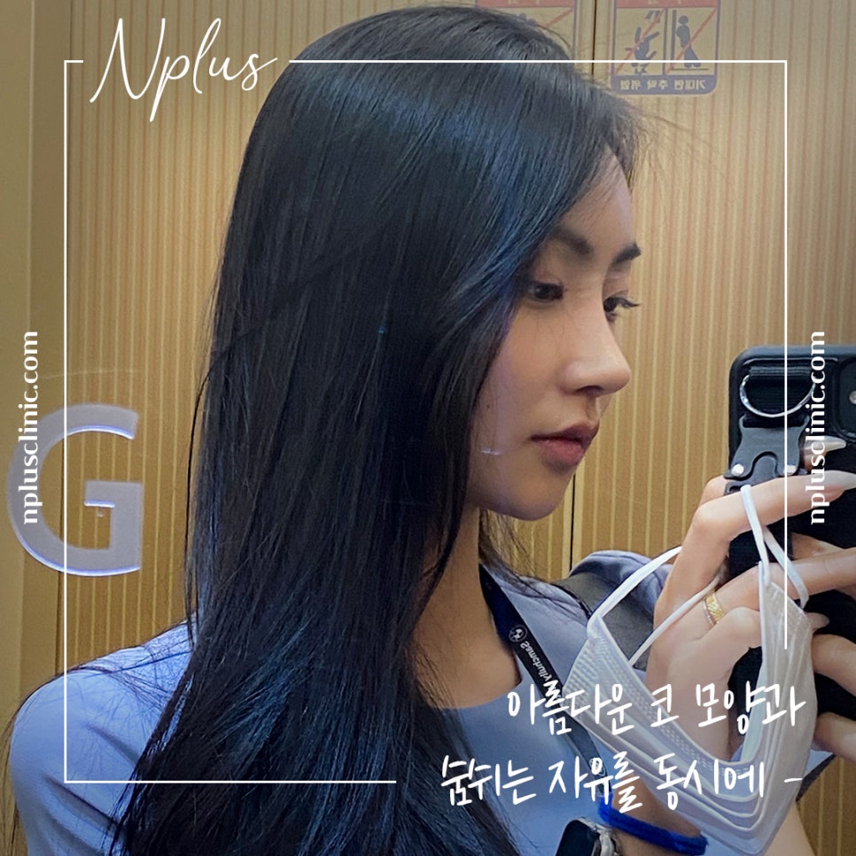 긴코성형 후기까지 알아보고 관련 이미지 6