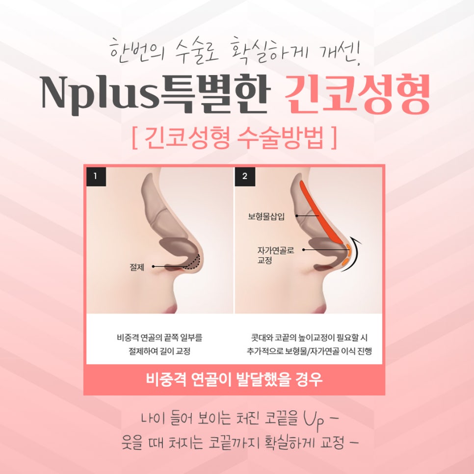 Learn More About Long Nose Surgery in Detail image 7