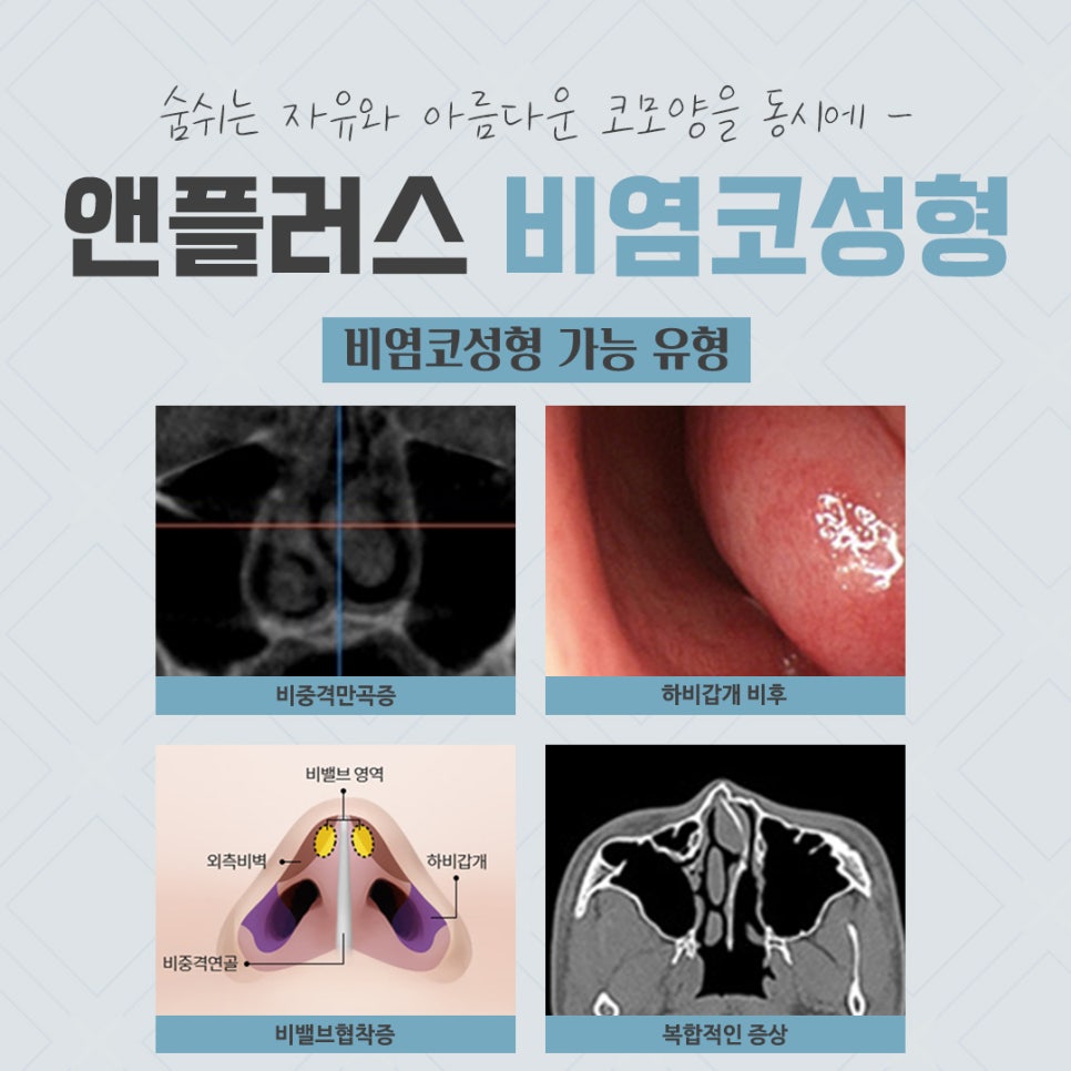 비염코성형후기 원인을 자세하게 알아보고 관련 이미지 5