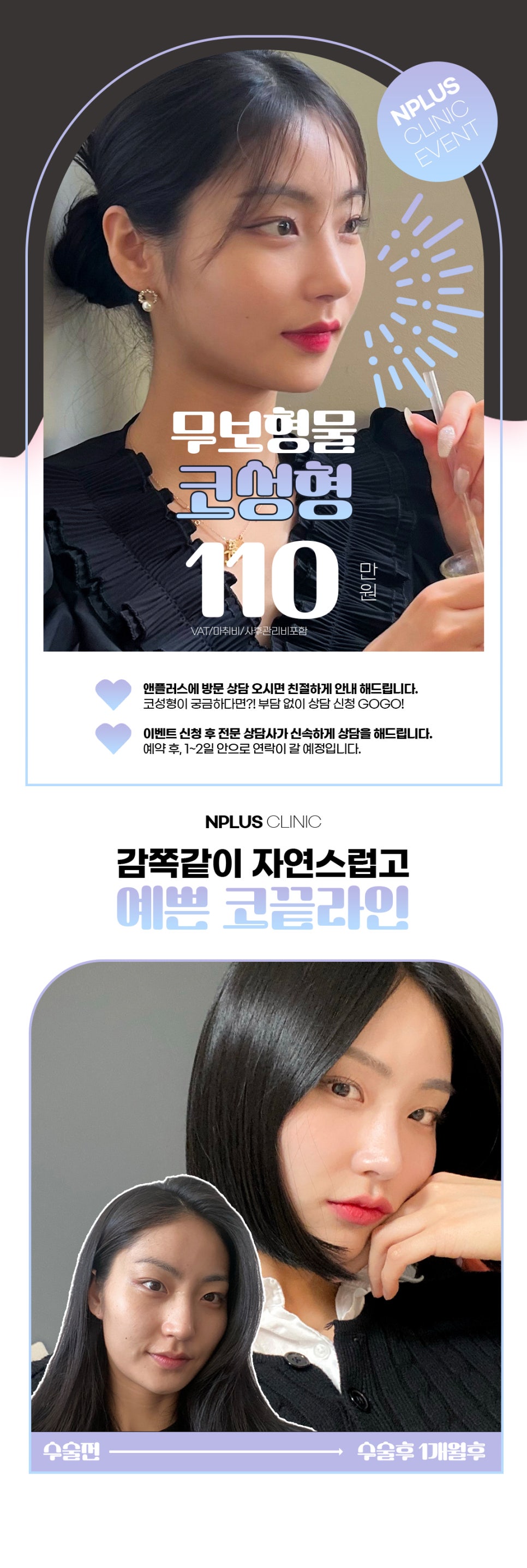 앤플러스에서 진행하고 있는 무보형물 코성형이벤트 관련 이미지 2