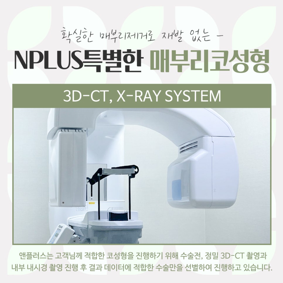 Detailed Hump Nose Surgery Review image 8