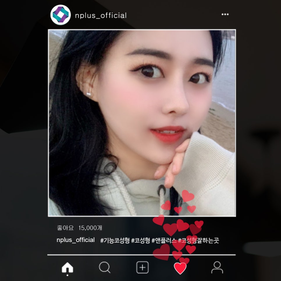 기능코성형후기 꼼꼼하게 알아보고 관련 이미지 1