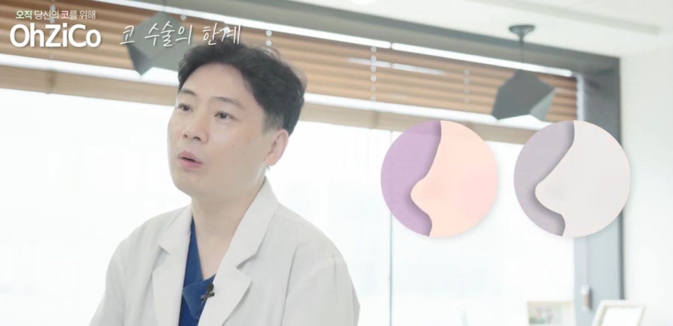 코성형 하면 예쁜코와 효과 없는 코! 관련 이미지 6
