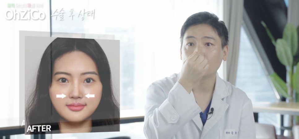짧은코수술 후기까지 자세하게 알아보고 관련 이미지 9