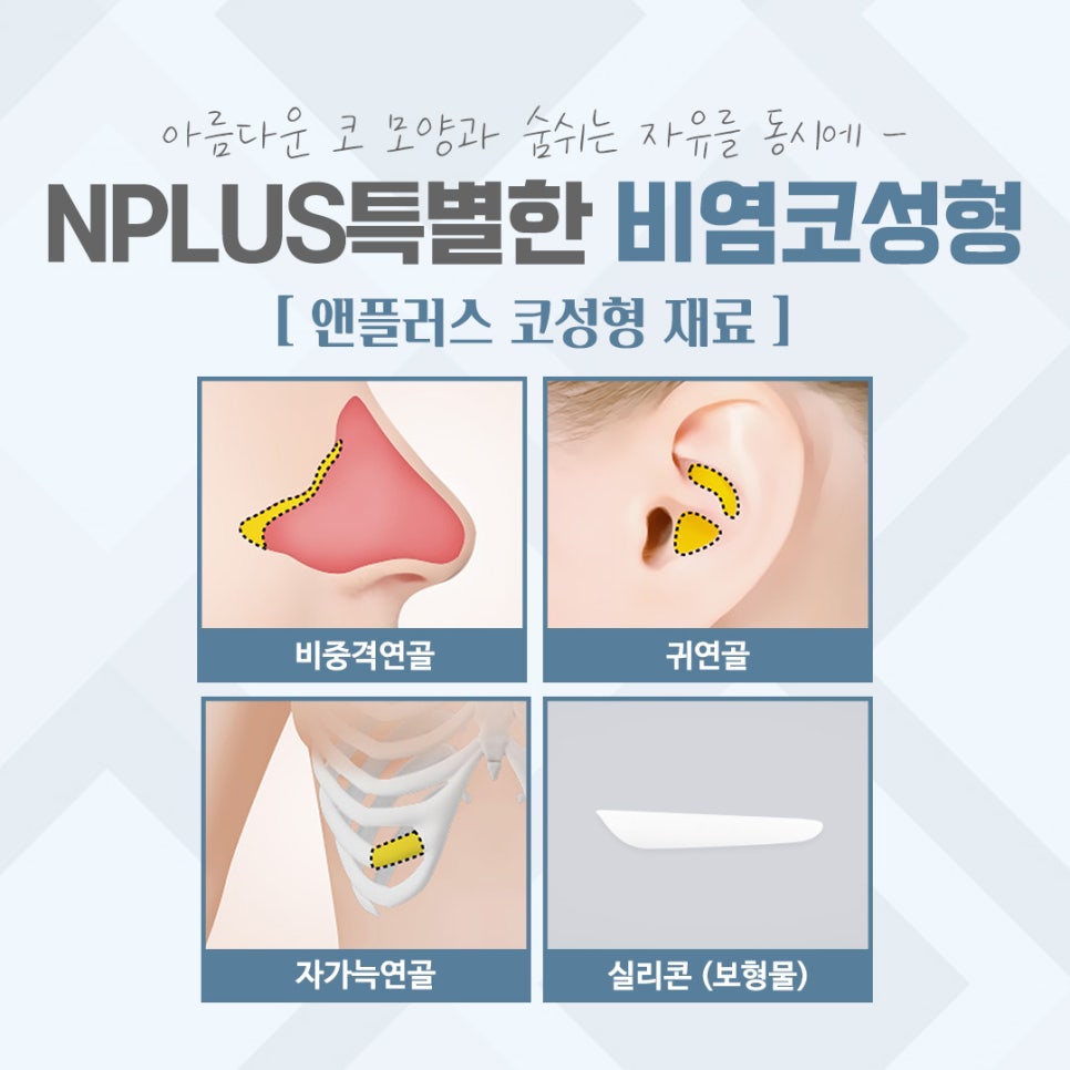 비염코수술후기 자세하게 알아보고 관련 이미지 9