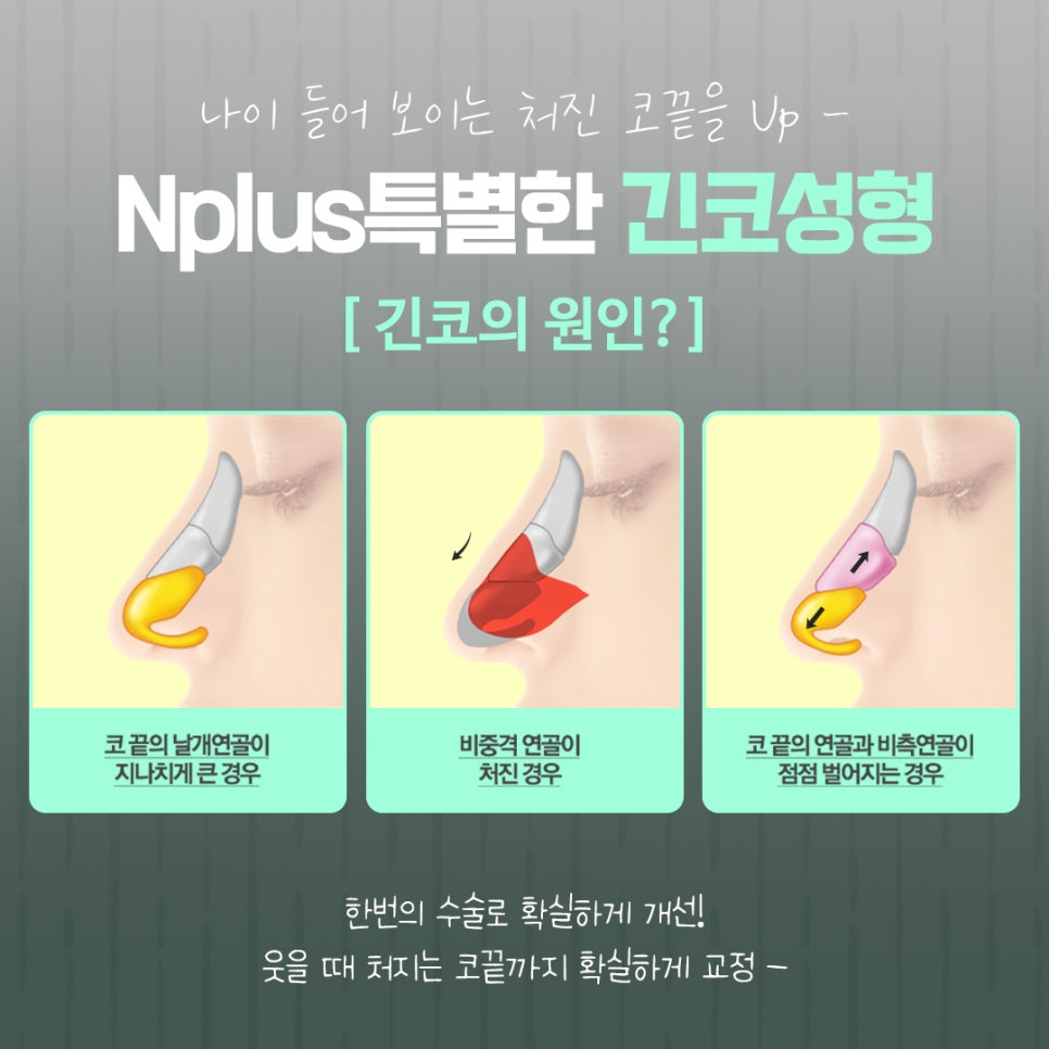 긴코수술을 통해 동안으로 관련 이미지 7