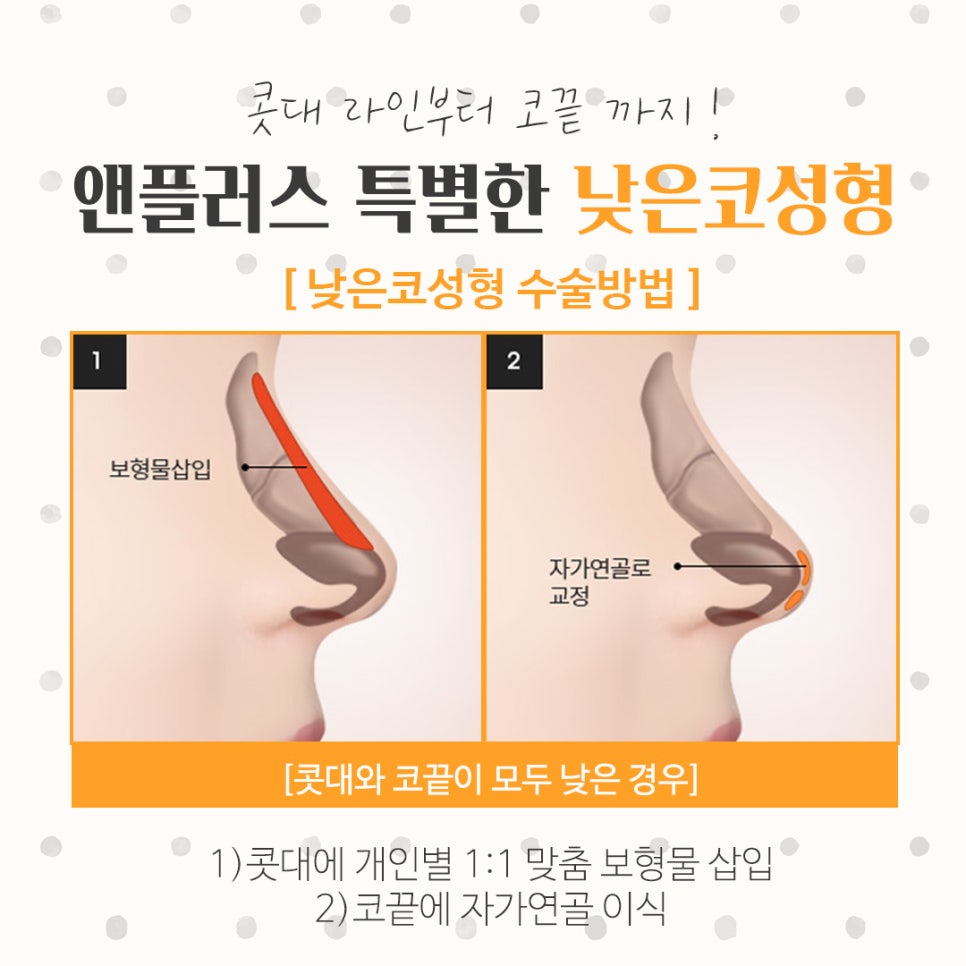 Check the Changes in Low Nose Surgery image 7