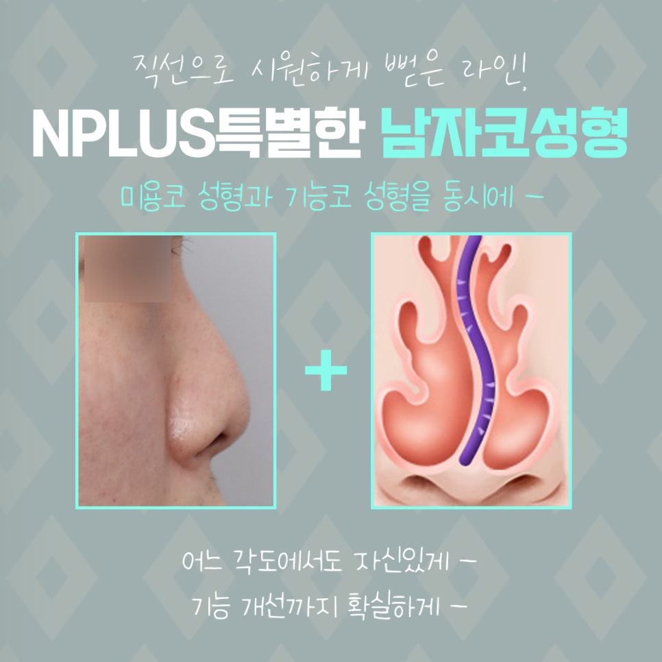 남자코수술전후 꼼꼼하게 체크하고 관련 이미지 8