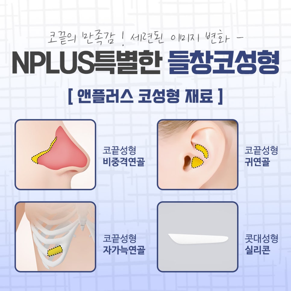 들창코성형 후기를 비교해 보고 관련 이미지 10