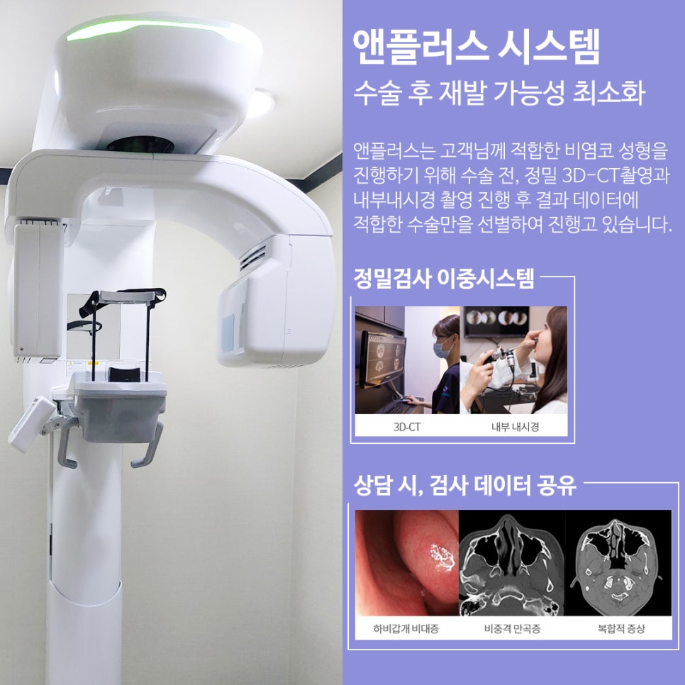 Male Nose Surgery, Considering Function as Well image 5