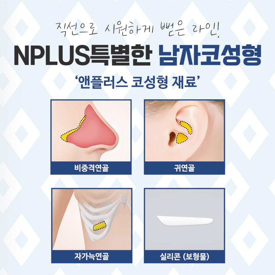 남자비염코성형 자세하게 알아보고 결정 관련 이미지 8
