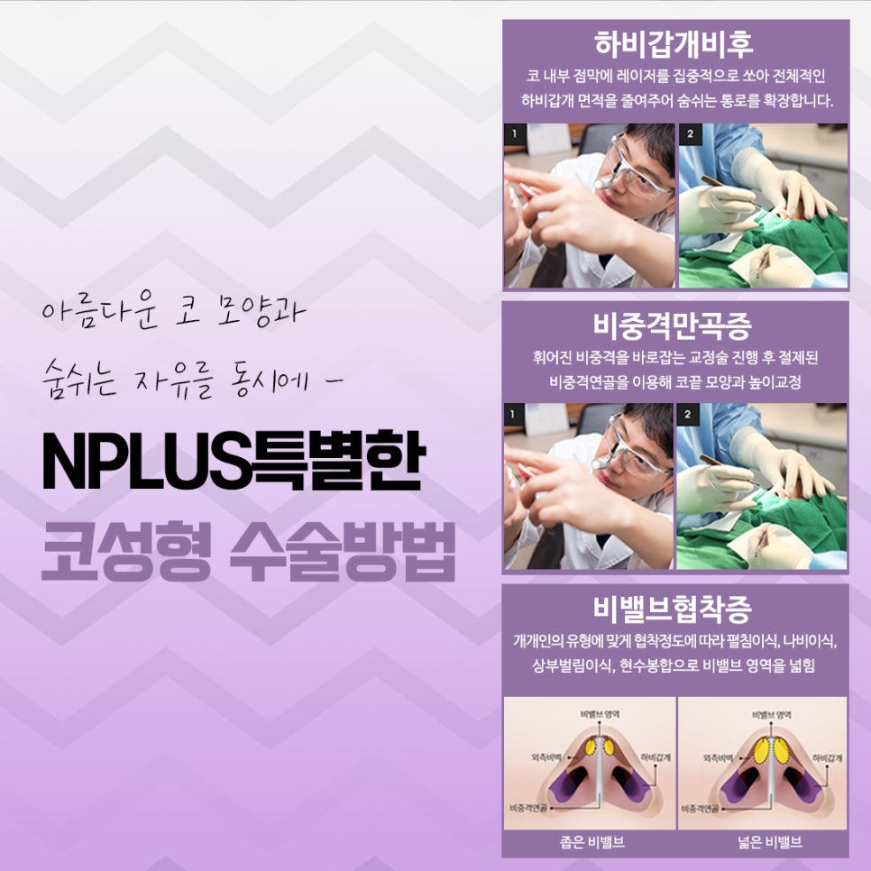 코수술전후 자연스러운 라인으로 관련 이미지 10