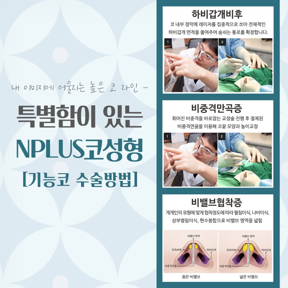 코성형잘하는병원 자연스러운 라인으로 관련 이미지 11