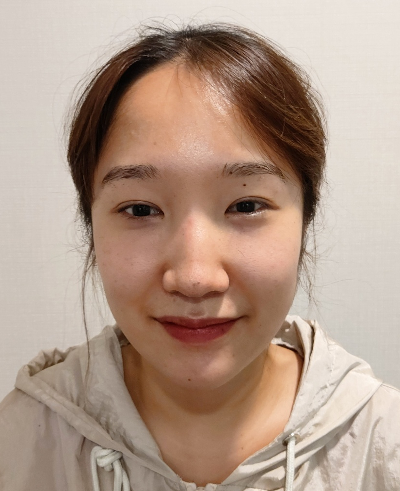 콧볼축소수술 꼭 안해도 되는 경우와 흉터 안 남는 방법? 관련 이미지 3