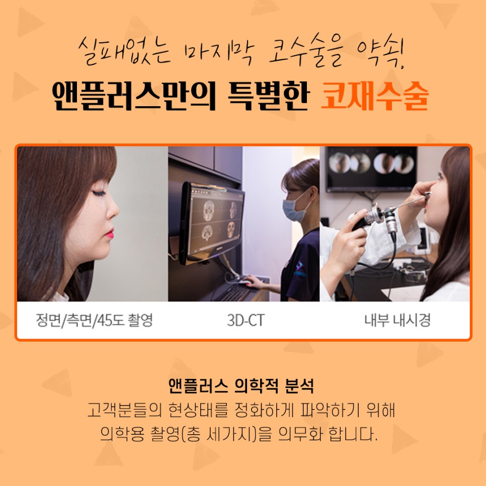 코재수술후기 자연스럽고 예쁘게 관련 이미지 7