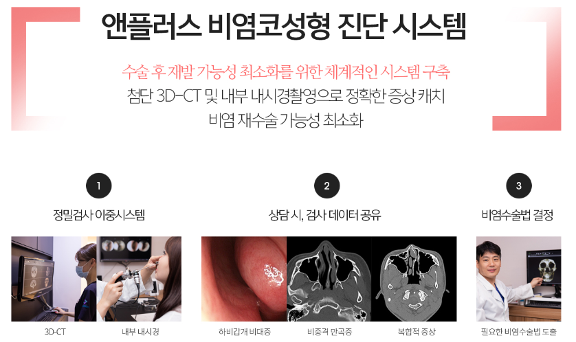 비염수술+코성형, 동시에 진행하자! 관련 이미지 6