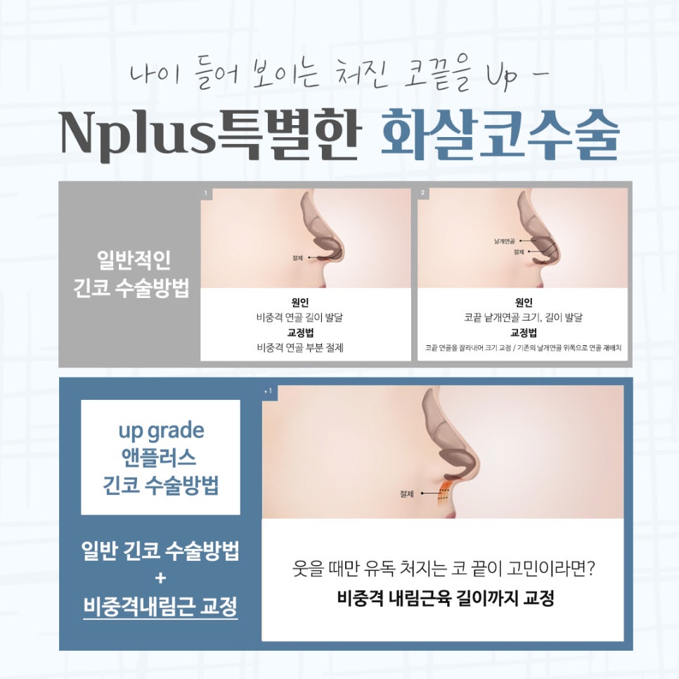 화살코수술 자세하게 알아보고 관련 이미지 10